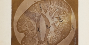 Zdjęcie mikroskopowe przekroju glisty ludzkiej.